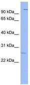 GS Homeobox 1 antibody, TA329378, Origene, Western Blot image 