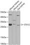 Syntaxin 12 antibody, GTX65901, GeneTex, Western Blot image 