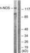 Nitric Oxide Synthase 1 antibody, LS-B9236, Lifespan Biosciences, Western Blot image 
