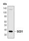 Stearoyl-CoA Desaturase antibody, MA5-14885, Invitrogen Antibodies, Western Blot image 