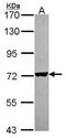 Arginyl-TRNA Synthetase antibody, GTX114704, GeneTex, Western Blot image 