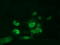 Aryl Hydrocarbon Receptor Nuclear Translocator antibody, LS-C115267, Lifespan Biosciences, Immunofluorescence image 