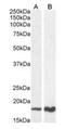 Cyclin-dependent kinase inhibitor 2A, isoform 1 antibody, orb125245, Biorbyt, Western Blot image 