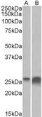 Apolipoprotein D antibody, STJ73057, St John