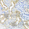 Branched Chain Keto Acid Dehydrogenase Kinase antibody, A8184, ABclonal Technology, Immunohistochemistry paraffin image 