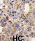 Histone Deacetylase 6 antibody, abx026070, Abbexa, Western Blot image 