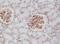 Platelet Derived Growth Factor Receptor Beta antibody, NBP2-61578, Novus Biologicals, Immunohistochemistry paraffin image 