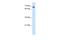 TATA-Box Binding Protein Associated Factor 6 antibody, A05993, Boster Biological Technology, Western Blot image 