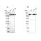 Isoleucyl-TRNA Synthetase 2, Mitochondrial antibody, NBP1-84639, Novus Biologicals, Western Blot image 