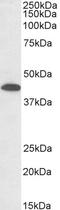 Cyclin Dependent Kinase 7 antibody, 43-678, ProSci, Enzyme Linked Immunosorbent Assay image 