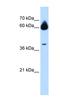 Matrix Metallopeptidase 23B antibody, NBP1-59459, Novus Biologicals, Western Blot image 