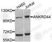 Ankyrin Repeat Domain 44 antibody, A8521, ABclonal Technology, Western Blot image 