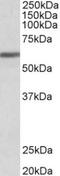 Zinc Finger Protein 703 antibody, TA311529, Origene, Western Blot image 