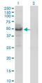 Phospholipid Transfer Protein antibody, LS-C105012, Lifespan Biosciences, Western Blot image 