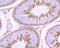 GLI Family Zinc Finger 1 antibody, NBP2-66867, Novus Biologicals, Immunohistochemistry paraffin image 