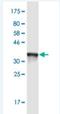 Alpha Tocopherol Transfer Protein antibody, H00007274-M01-50ug, Novus Biologicals, Western Blot image 