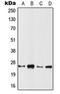 RAS Related 2 antibody, LS-C353319, Lifespan Biosciences, Western Blot image 