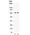 Involucrin antibody, R31905, NSJ Bioreagents, Western Blot image 