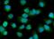 Pyruvate Dehyrogenase Phosphatase Catalytic Subunit 1 antibody, A05607-2, Boster Biological Technology, Immunofluorescence image 