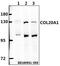 Collagen Type XX Alpha 1 Chain antibody, A14855-1, Boster Biological Technology, Western Blot image 