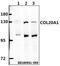Collagen Type XX Alpha 1 Chain antibody, A14855-1, Boster Biological Technology, Western Blot image 