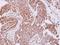 Ribosomal Protein L7a antibody, GTX114727, GeneTex, Immunohistochemistry paraffin image 