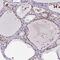 Nucleoporin NUP188 homolog antibody, HPA061750, Atlas Antibodies, Immunohistochemistry paraffin image 