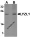 Lysozyme Like 1 antibody, 6947, ProSci, Western Blot image 