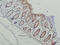 Galectin 3 antibody, GTX34034, GeneTex, Immunohistochemistry paraffin image 