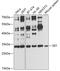 SET Nuclear Proto-Oncogene antibody, A02211, Boster Biological Technology, Western Blot image 