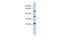 Centromere Protein M antibody, PA5-42854, Invitrogen Antibodies, Western Blot image 