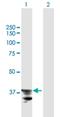 ADAM Metallopeptidase Domain 22 antibody, H00053616-B01P, Novus Biologicals, Western Blot image 