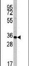 Caspase 6 antibody, PA5-11390, Invitrogen Antibodies, Western Blot image 