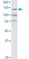 Arginine-Glutamic Acid Dipeptide Repeats antibody, H00000473-M06, Novus Biologicals, Western Blot image 