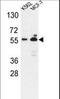 Glucose-6-Phosphate Dehydrogenase antibody, LS-C166304, Lifespan Biosciences, Western Blot image 