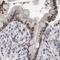 RNA Binding Motif Protein 6 antibody, PA5-55295, Invitrogen Antibodies, Immunohistochemistry paraffin image 