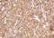 Fibronectin 1 antibody, GTX112794, GeneTex, Immunohistochemistry paraffin image 