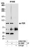 FER Tyrosine Kinase antibody, A304-310A, Bethyl Labs, Immunoprecipitation image 