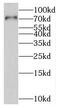 MAGUK p55 subfamily member 5 antibody, FNab05289, FineTest, Western Blot image 