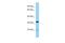 Thioredoxin Related Transmembrane Protein 2 antibody, A11291, Boster Biological Technology, Western Blot image 