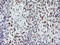 BTB Domain And CNC Homolog 1 antibody, LS-C173634, Lifespan Biosciences, Immunohistochemistry paraffin image 