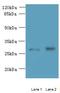 Transmembrane Protein 38B antibody, A61418-100, Epigentek, Western Blot image 