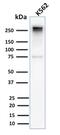 Spectrin Alpha, Erythrocytic 1 antibody, GTX02715, GeneTex, Western Blot image 