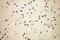 Death Effector Domain Containing 2 antibody, 14574-1-AP, Proteintech Group, Immunohistochemistry paraffin image 