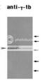 Tubulin Gamma 1 antibody, 69-001, BioAcademia Inc, Western Blot image 