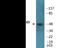 SMAD Family Member 3 antibody, EKC1960, Boster Biological Technology, Western Blot image 