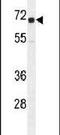 Insulin Like Growth Factor 2 MRNA Binding Protein 1 antibody, PA5-23968, Invitrogen Antibodies, Western Blot image 