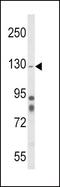 Integrin Subunit Alpha 1 antibody, GTX81008, GeneTex, Western Blot image 