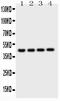 Cathepsin D antibody, LS-C313443, Lifespan Biosciences, Western Blot image 