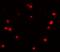 Progesterone Immunomodulatory Binding Factor 1 antibody, A04518, Boster Biological Technology, Immunofluorescence image 